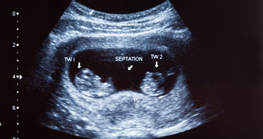 FIV y tratamientos para embarazo gemelar para personas de  El Salvador